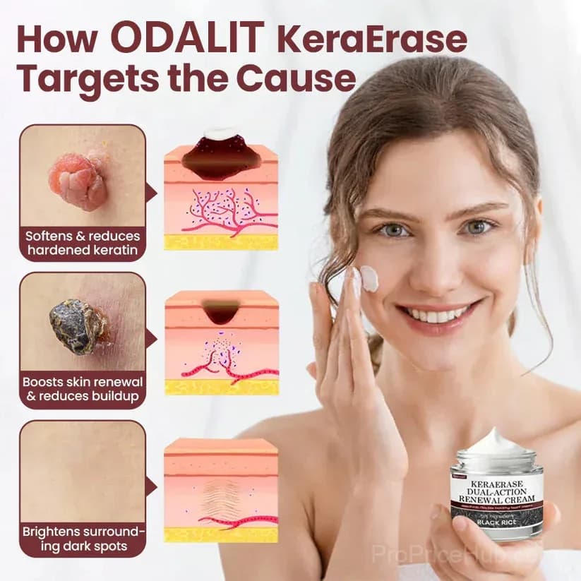 KeraErase Dual-Action Renewal Cream - View 2