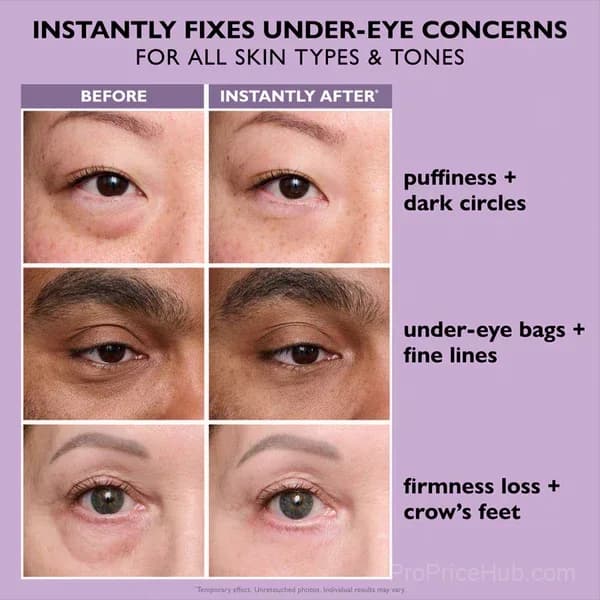 Eye Bag Instant Eraser - Under-Eye Face Care Treatment - View 2