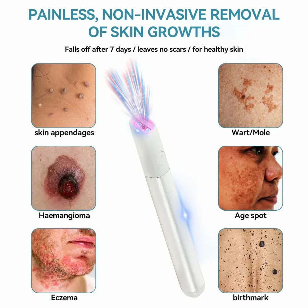 All-in-One CO₂ Laser Eraser Pen for Moles, Warts & Skin Flaws - View 2