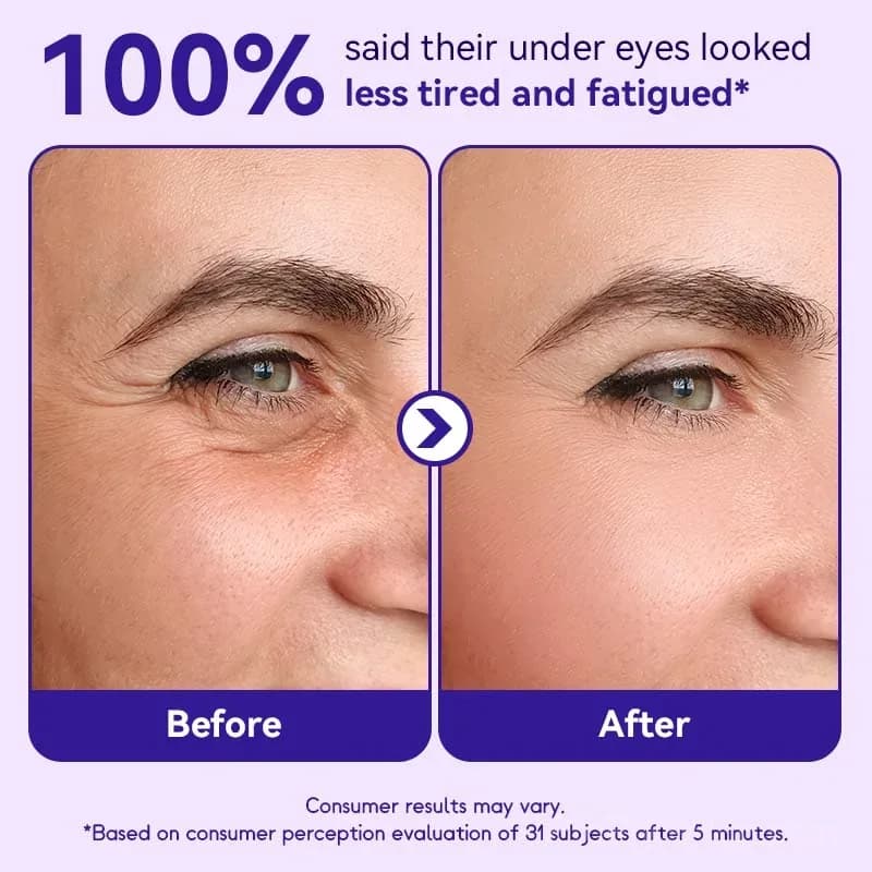Instant Lift Eye Gel for Bags and Puffiness - View 2