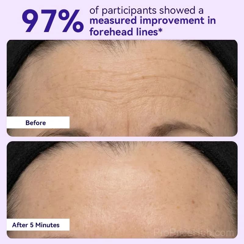 Instant Lift Eye Gel for Bags and Puffiness - View 3