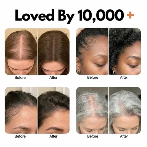 Hair Growth Serum - View 2
