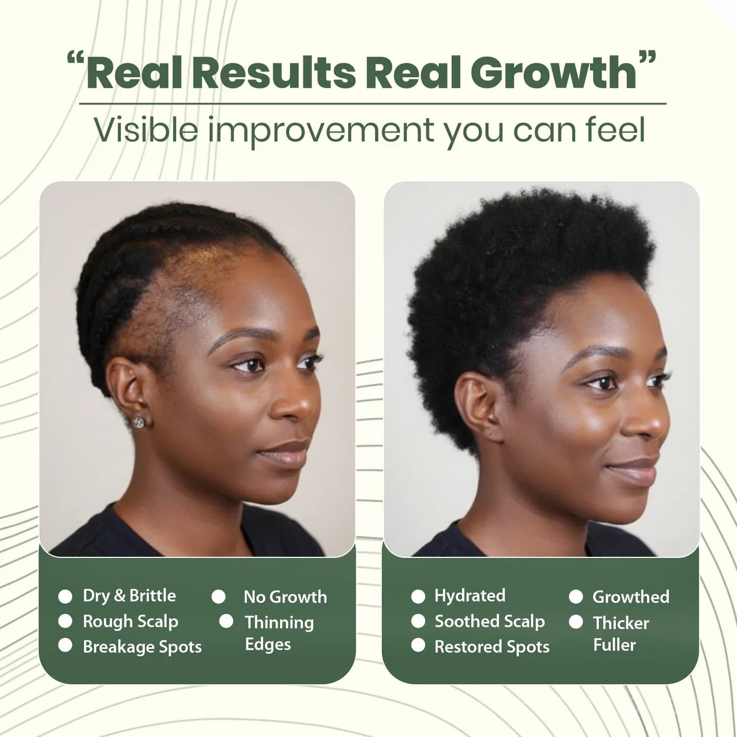 Batana Natural Hair Growth Oil - Scalp Treatment - View 2