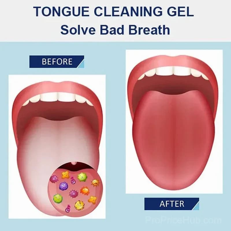 Probiotic Tongue Cleaning Gel Set - View 8