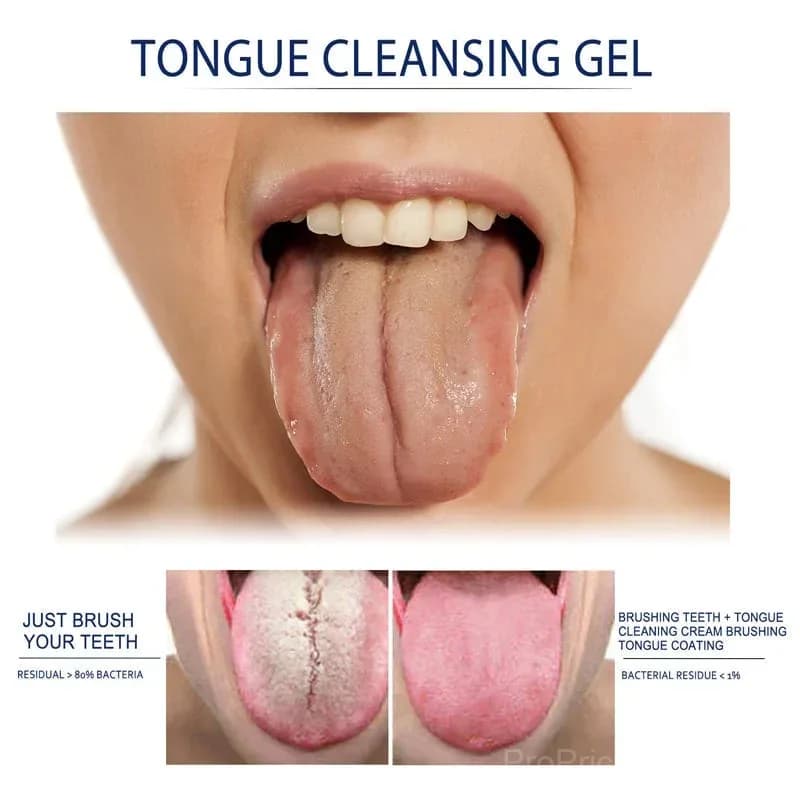 Probiotic Tongue Cleaning Gel Set - View 5