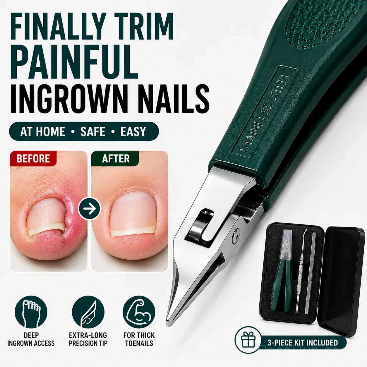 Eagle Beak Beveled Nail Clippers – 3-Piece Grooming Kit - View 1